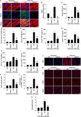 Receptor-Interacting Protein Kinase 3 Suppresses Mitophagy Activation via the Yes-Associated Protein/Transcription Factor EB Pathways in Septic Cardiomyopathy